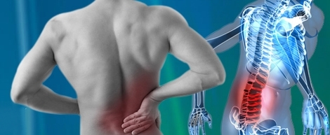 Osteopatia pode ajudar na Hérnia de Disco