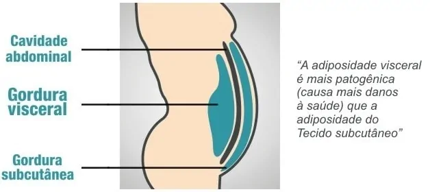 Gordura-Subcutânea-e-Gordura-Visceral