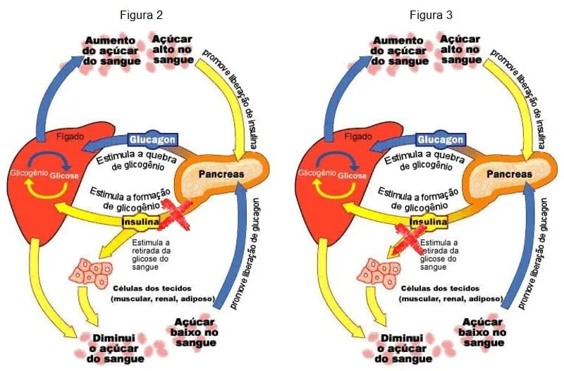 diabetes diabetico hiperglicemia 3