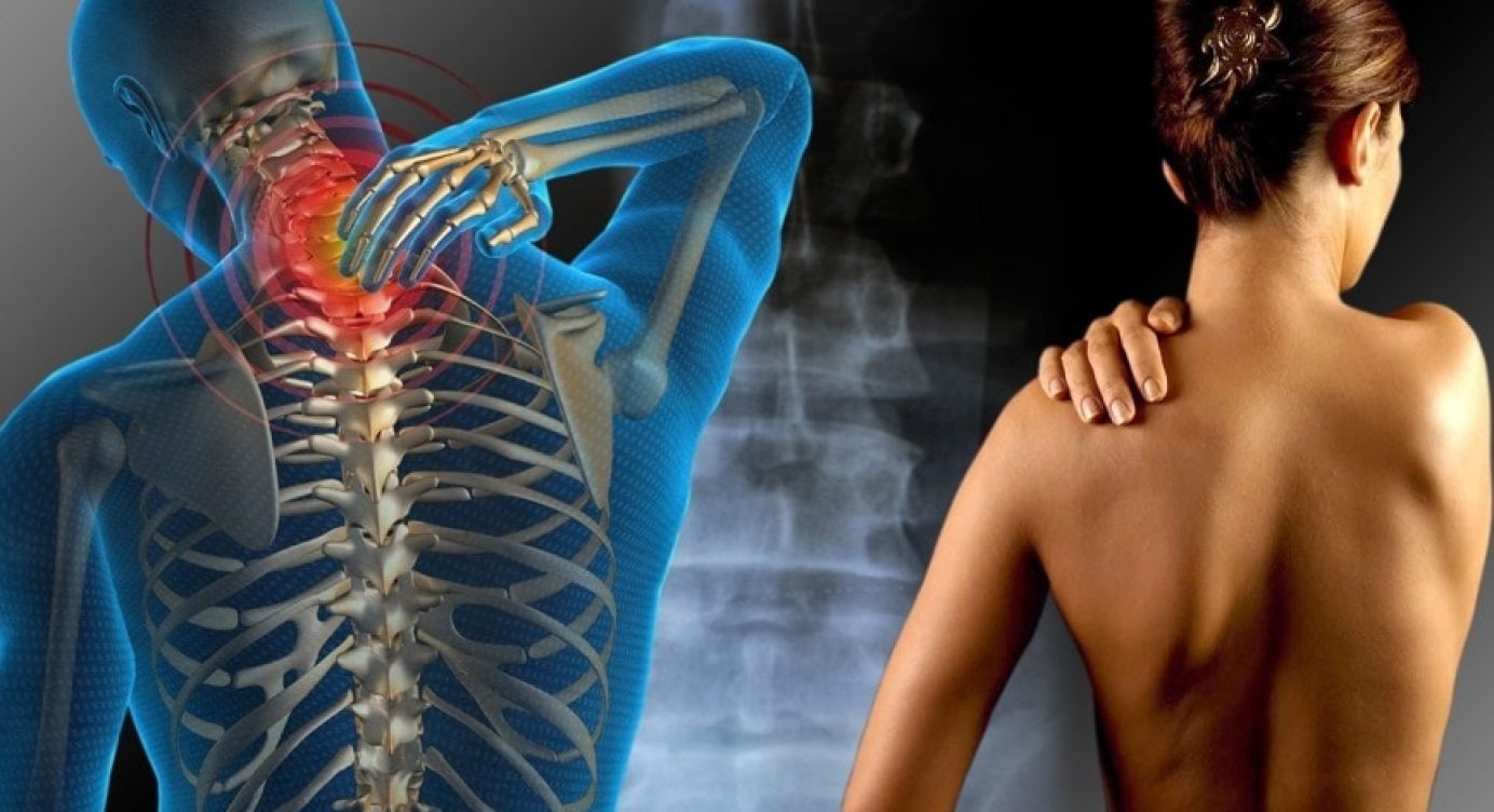 Entenda o que é Fibromialgia e conheça Exercícios que podem ajudar nessa questão!