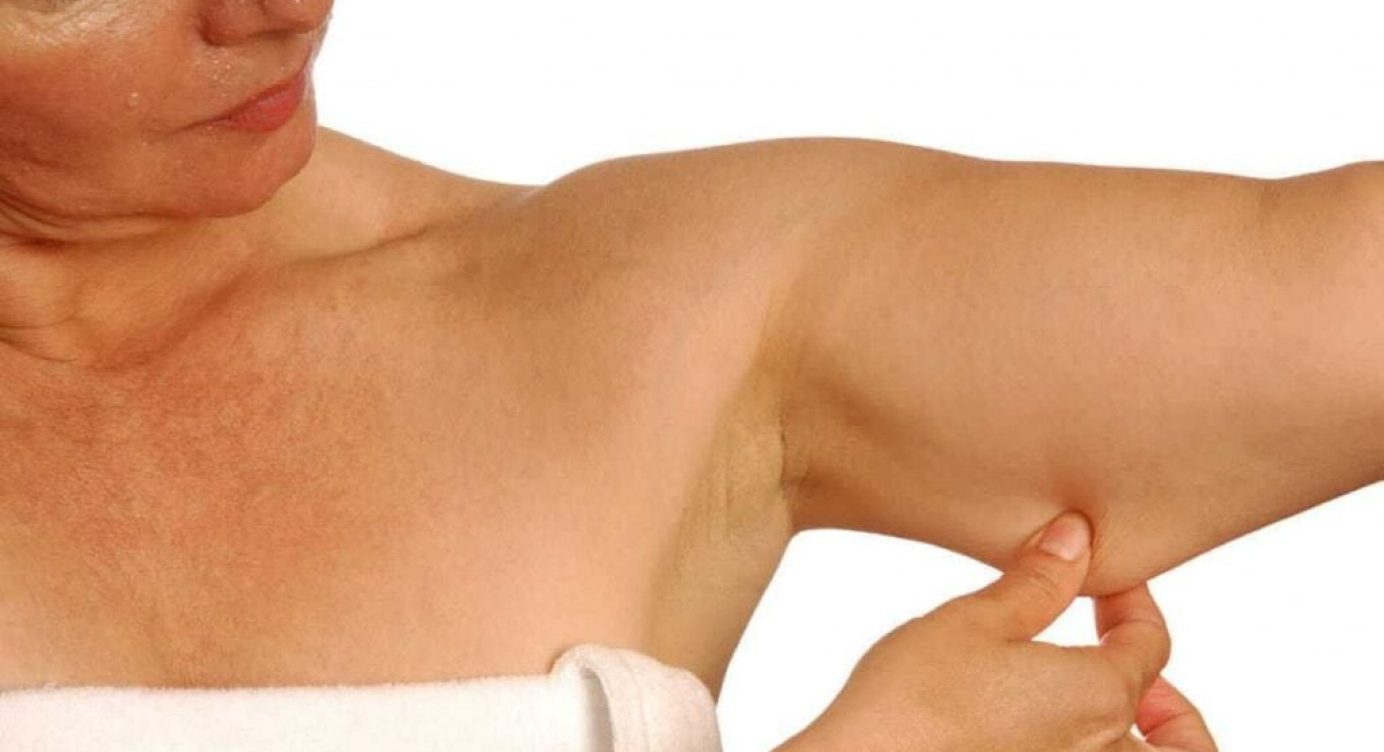 5 dicas para reduzir o acúmulo de Gorduras nas Costas e nos Braços