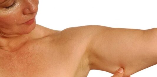 5 dicas para reduzir o acúmulo de Gorduras nas Costas e nos Braços Gorduras nas Costas e nos Braços