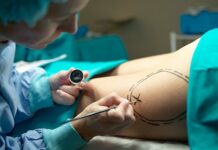 Conheça os Malefícios da Lipoaspiração e porque ela pode Não ajudar a Perder Barriga Lipoaspiração