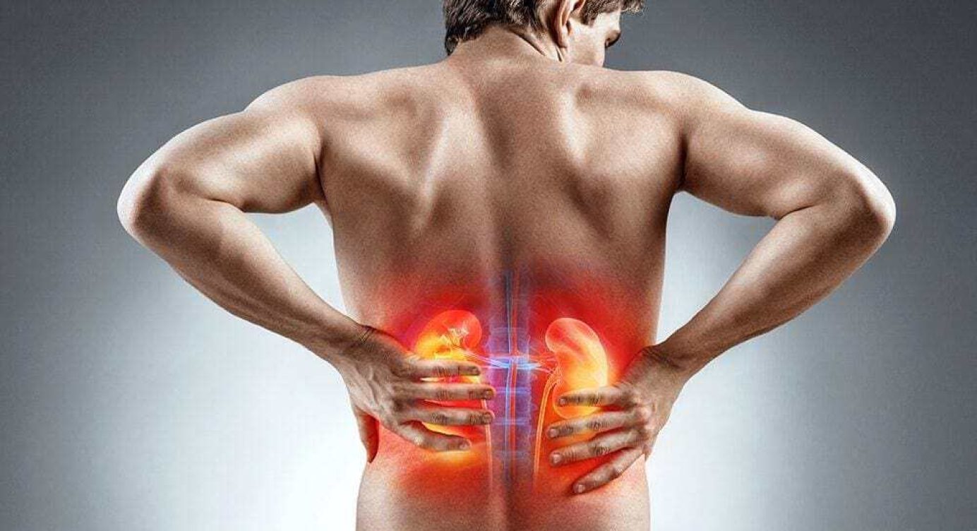 Quem tem Pedra nos Rins pode tomar Creatina? (todo cuidado é pouco)