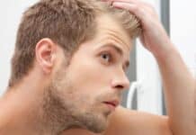 Creatina provoca queda de cabelo? O suplemento pode causar calvície? Creatina provoca queda de cabelo? O suplemento pode causar calvície?