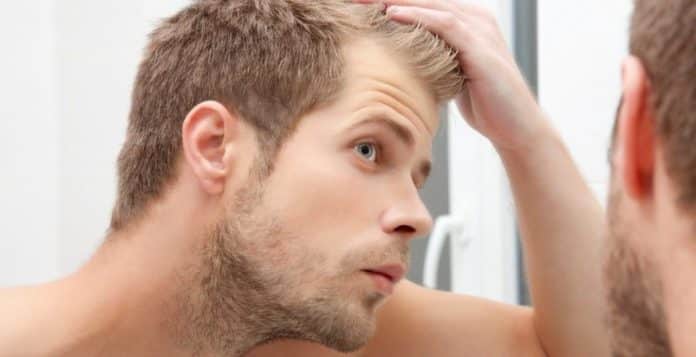 Creatina provoca queda de cabelo? O suplemento pode causar calvície?