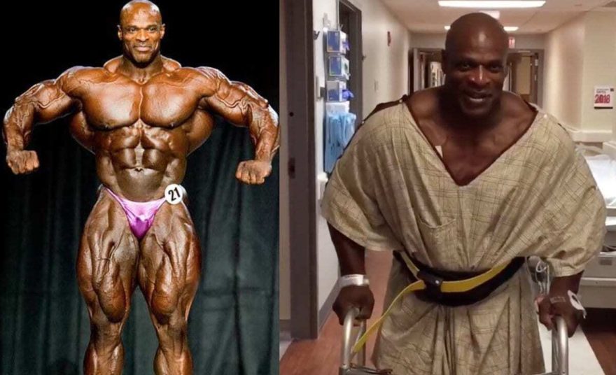 Fisiculturista Ronnie Coleman em competição e após cirurgia.