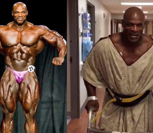 Fisiculturista Ronnie Coleman (história e como está atualmente) Fisiculturista Ronnie Coleman em competição e após cirurgia.