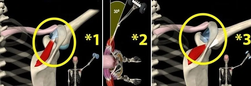 como fazer elevação lateral