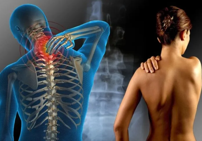 fibromialgia dor exercicio fibromialgia dor exercicio