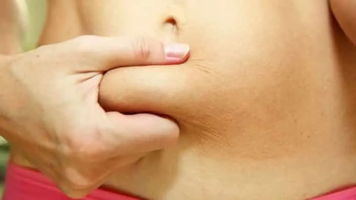 Gordura abdominal feminina Gordura na região abdominal de uma mulher.