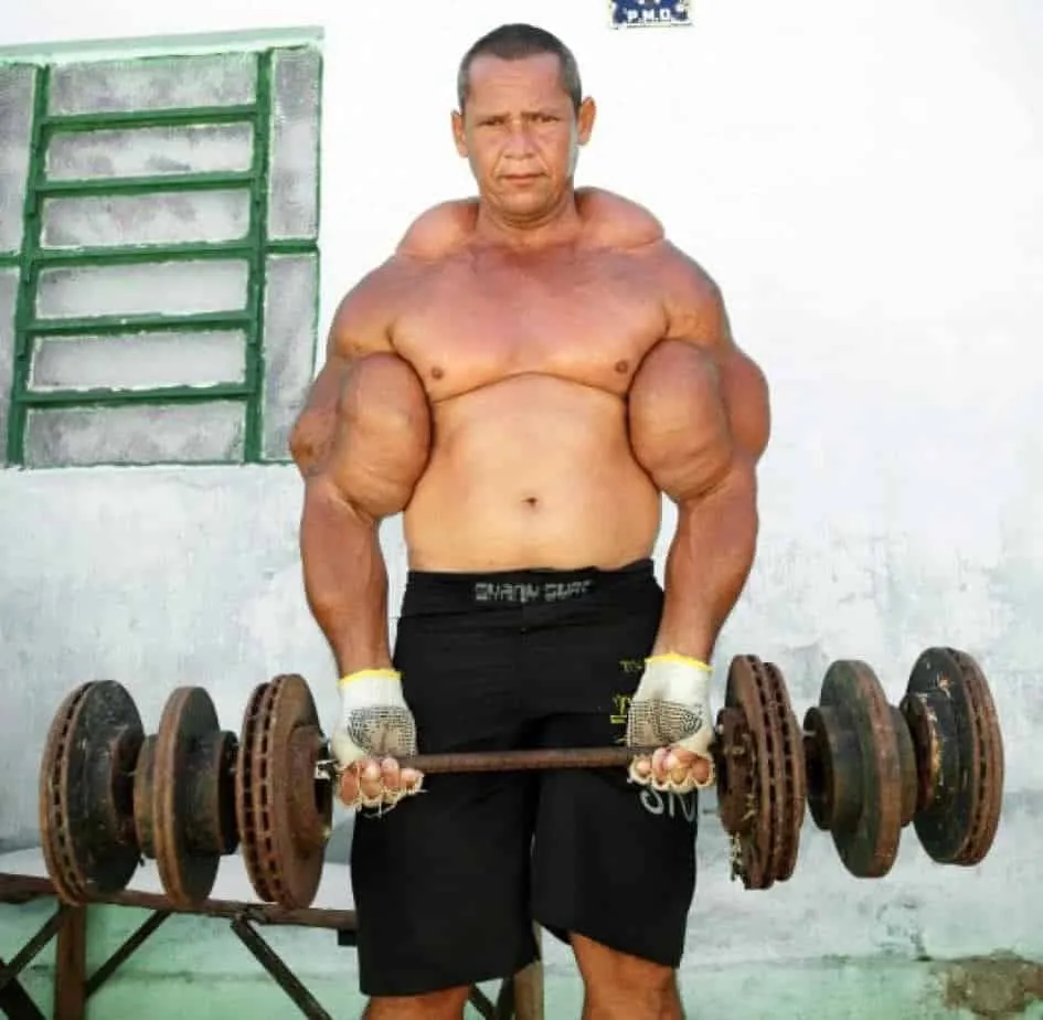 Homem musculoso com braços desproporcionalmente grandes levantando halteres.
