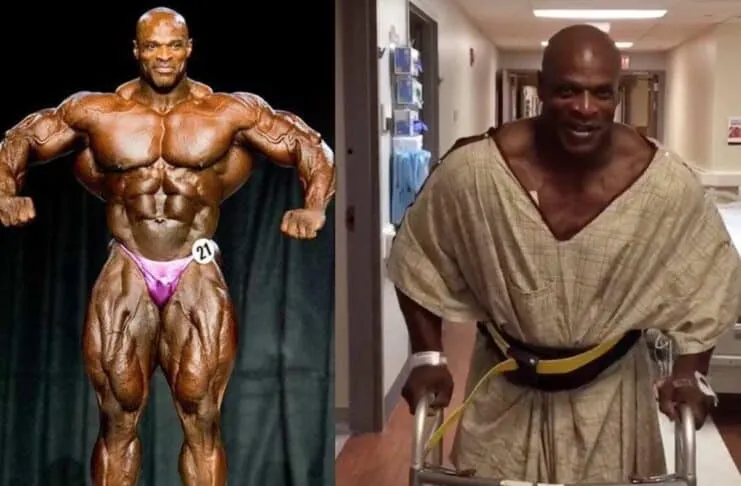 Fisiculturista Ronnie Coleman em competição e após cirurgia.